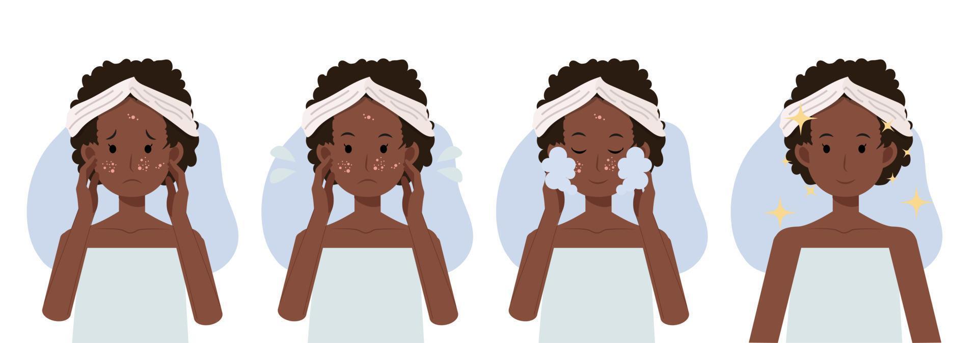 huidverzorging concept, gezichtsreiniging schuim, acne behandeling voor en na, Afro-Amerikaanse vrouw. platte vector cartoon afbeelding