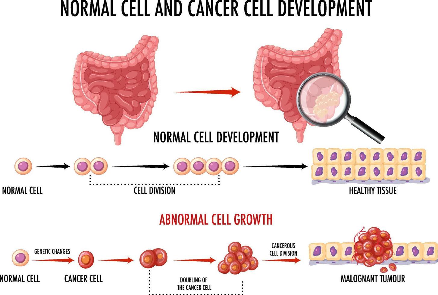 diagram dat normale en kankercellen bij de mens toont vector