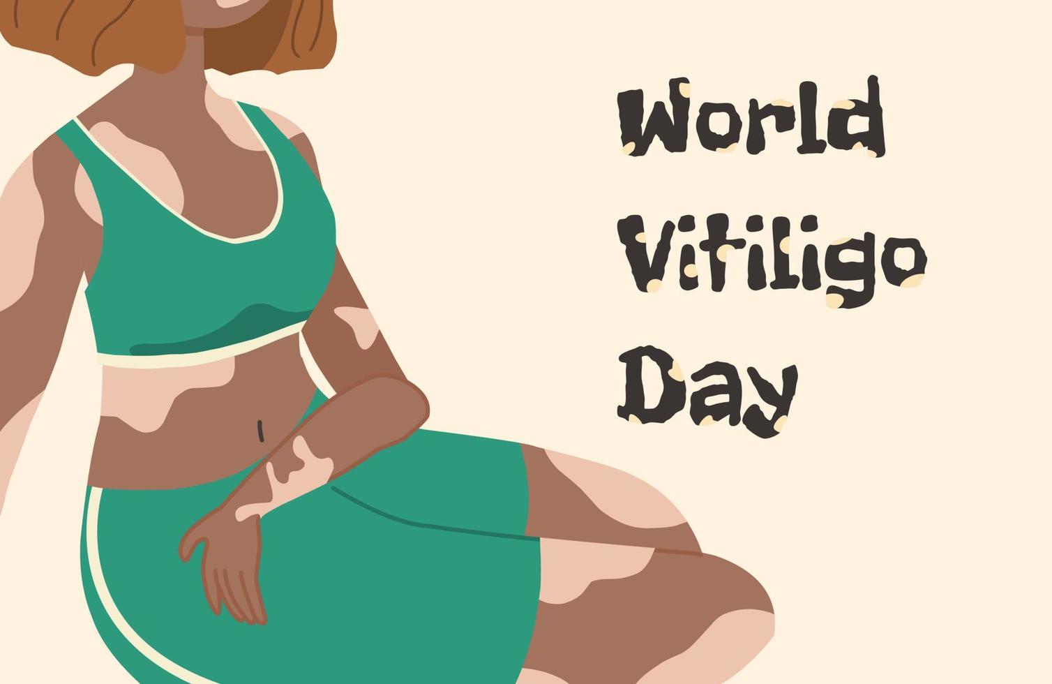 wereld vitiligo dag. vectorillustratie in een vlakke stijl. depigmentatie van de huid. vector