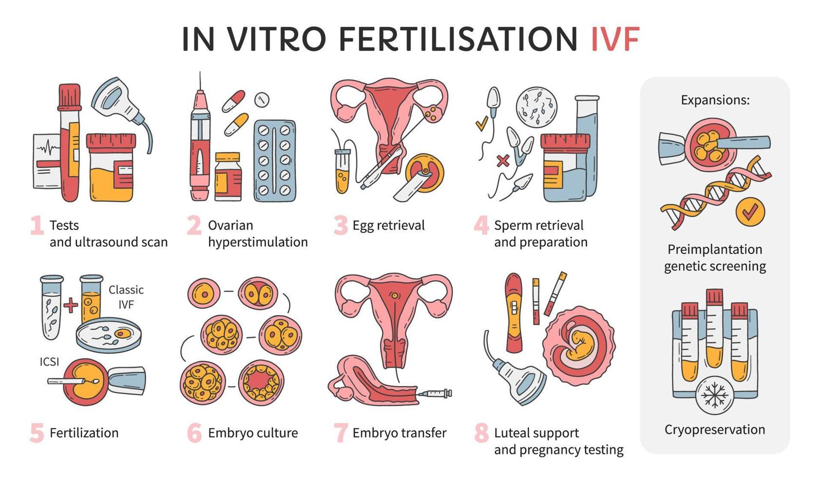 in-vitrofertilisatie ivf vector infographic en onvruchtbaarheidsbehandelingsschema. ovariële hyperstimulatie, kunstmatige inseminatie, embryocultuur en cryopreservatie. medische procedure voor zwangerschap