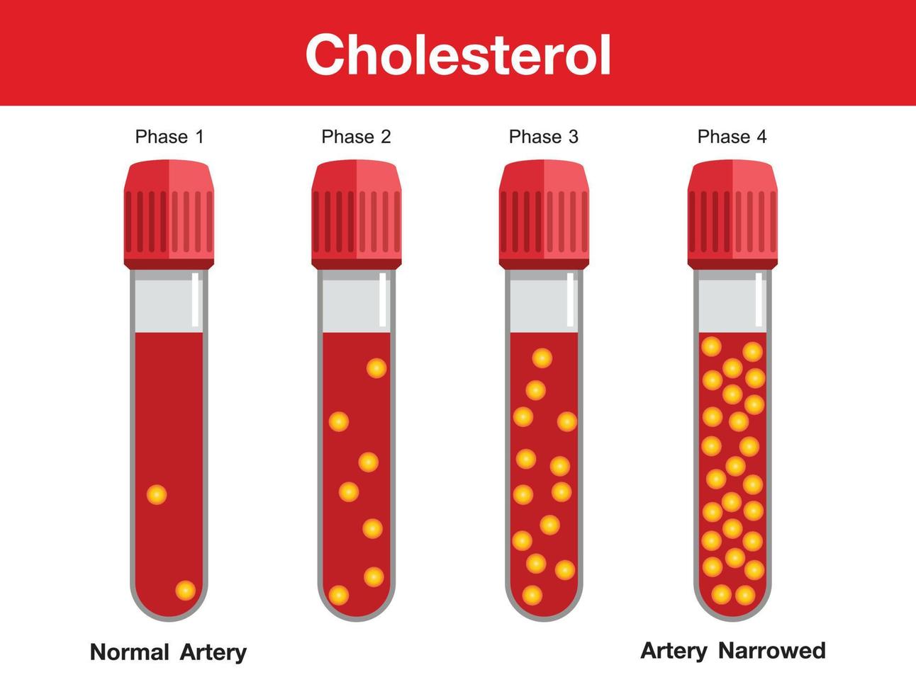 cholesterol in slagader, gezondheidsrisico, vectorontwerp vector