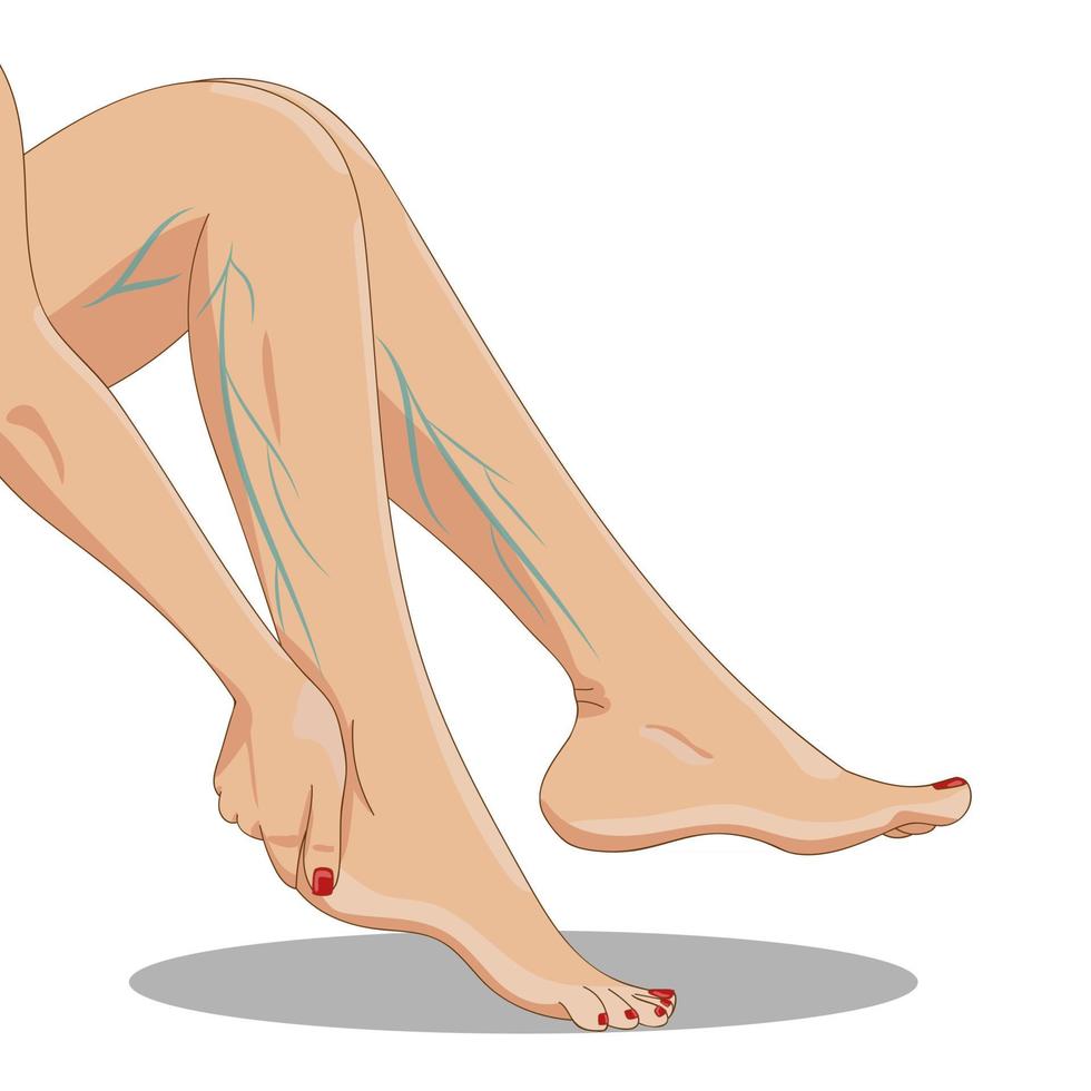 spataderen. vermoeide vrouwelijke benen zitten, zijaanzicht, met spataderen, één hand boven de enkel. vector