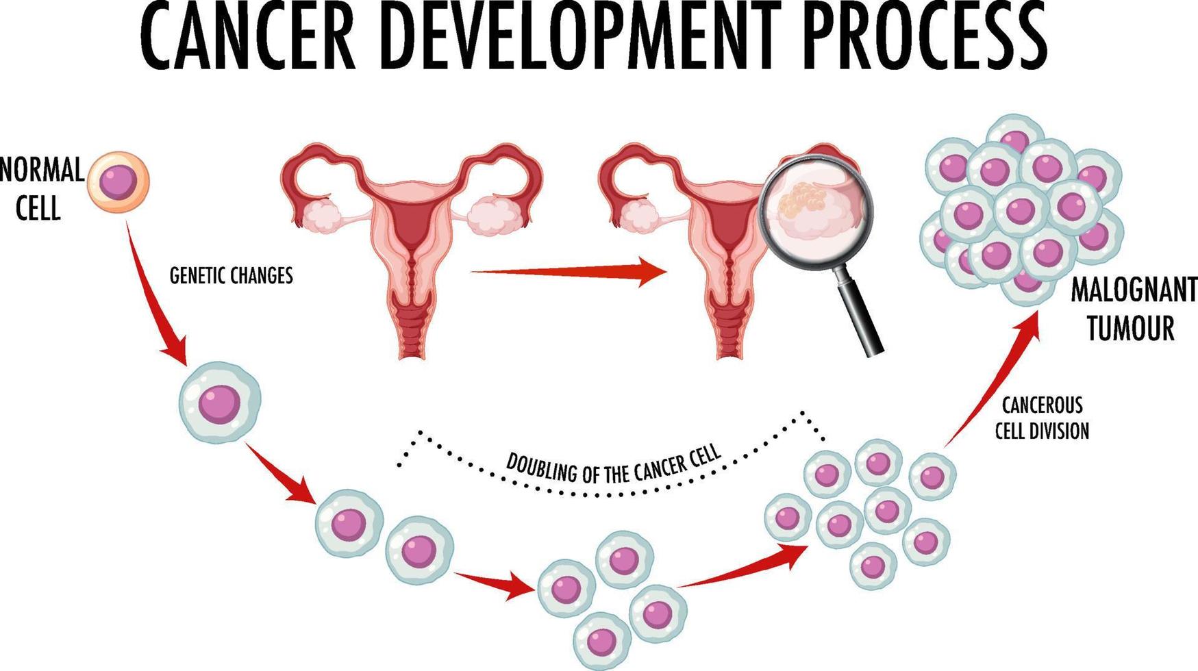 diagram dat normale en kankercellen bij de mens toont vector