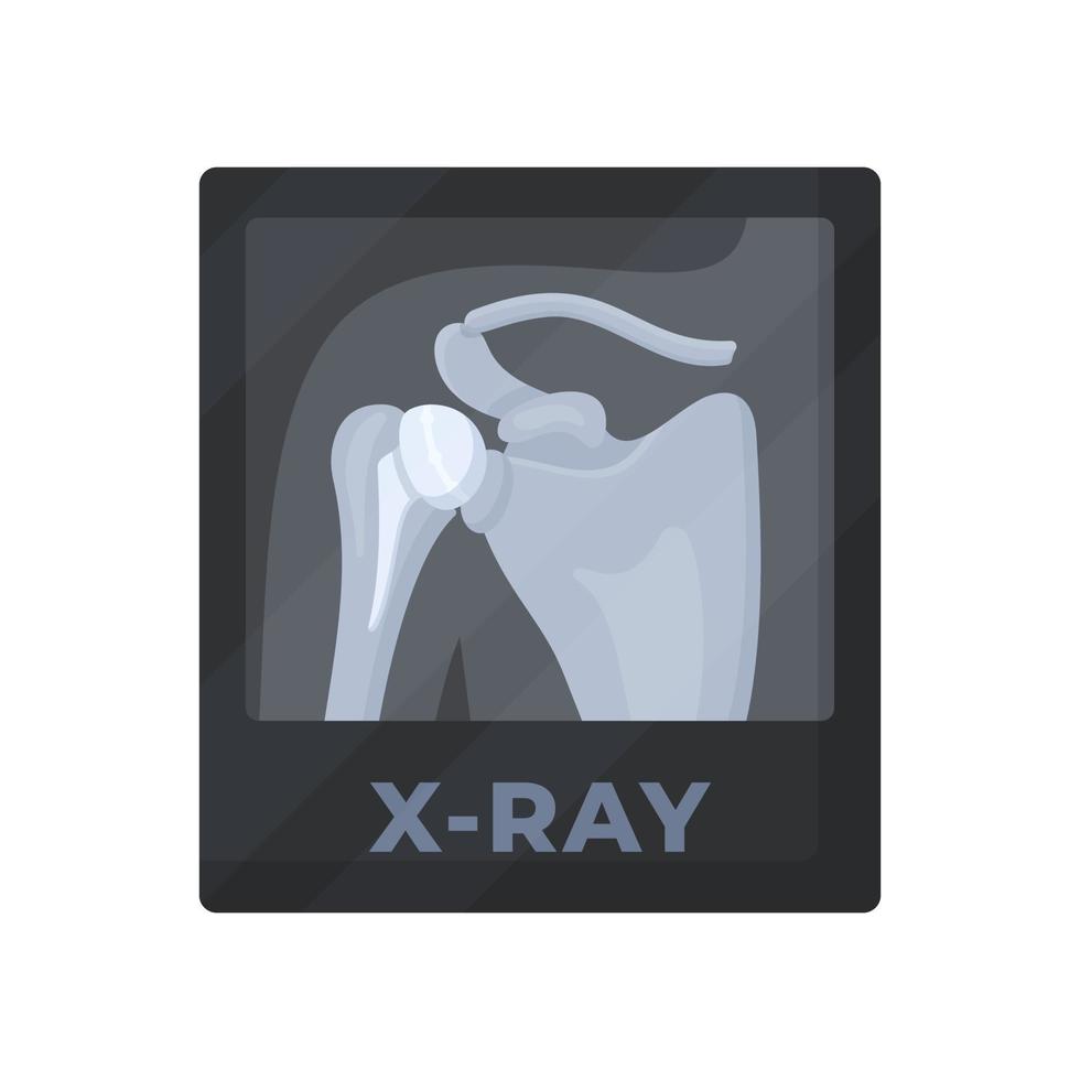 röntgenfoto van de menselijke scapula. een studie van de interne structuur van objecten die met röntgenstralen worden geprojecteerd. vector