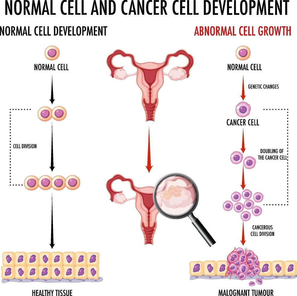 diagram dat normale en kankercellen bij de mens toont vector