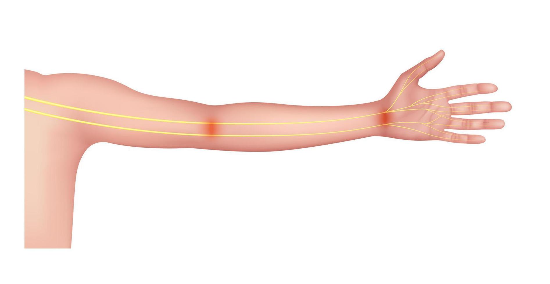 zenuw van de arm over de menselijke anatomie geel. op een witte achtergrond. medische en wetenschappelijke concepten. 3D-vector eps10. vector