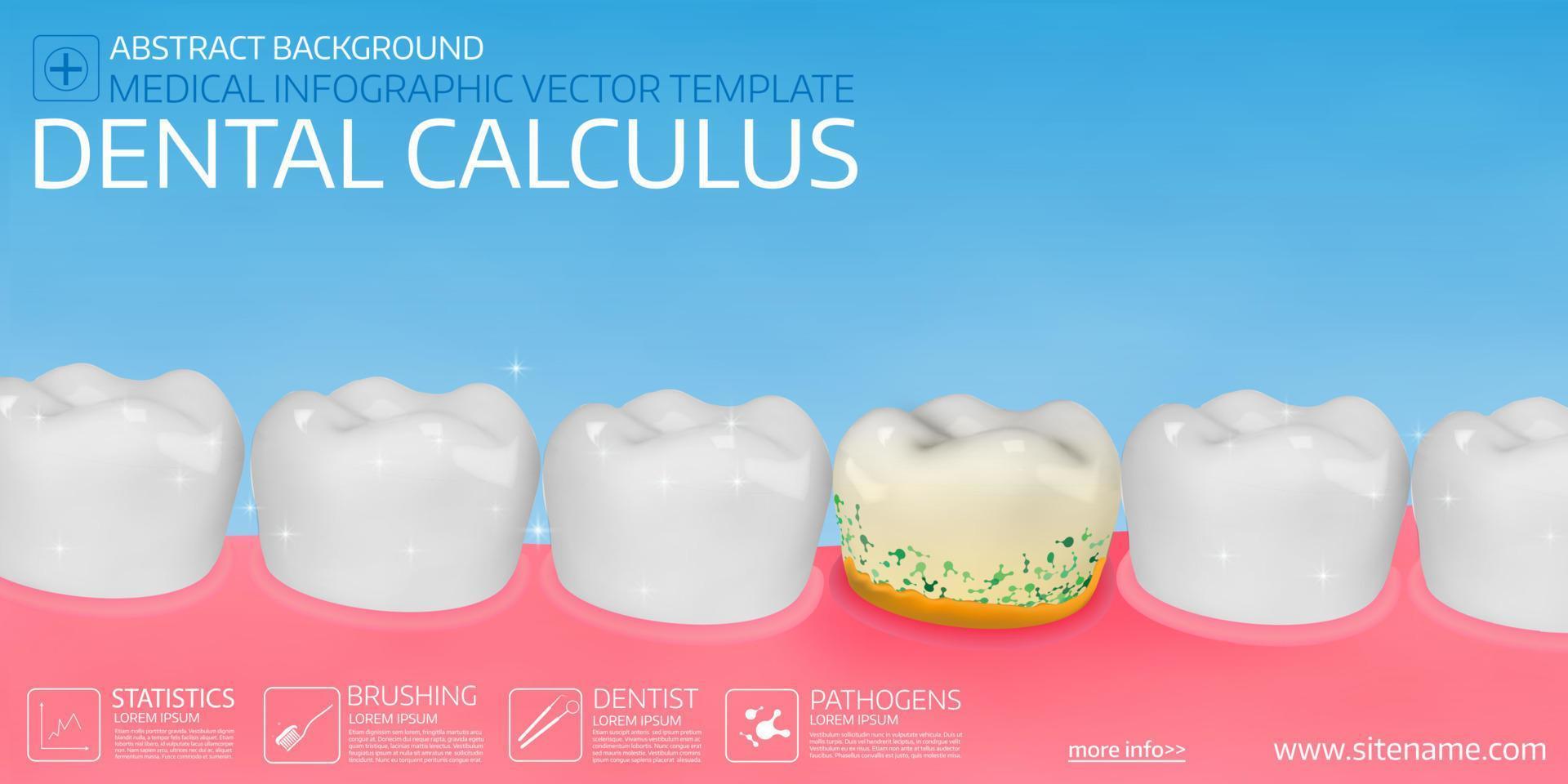 tandheelkundige calculus horizontale medische sjabloon voor spandoek. vector