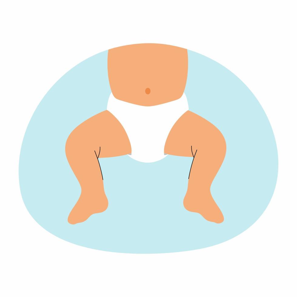 baby in luier. heupdysplasie. vectorillustratie. vector