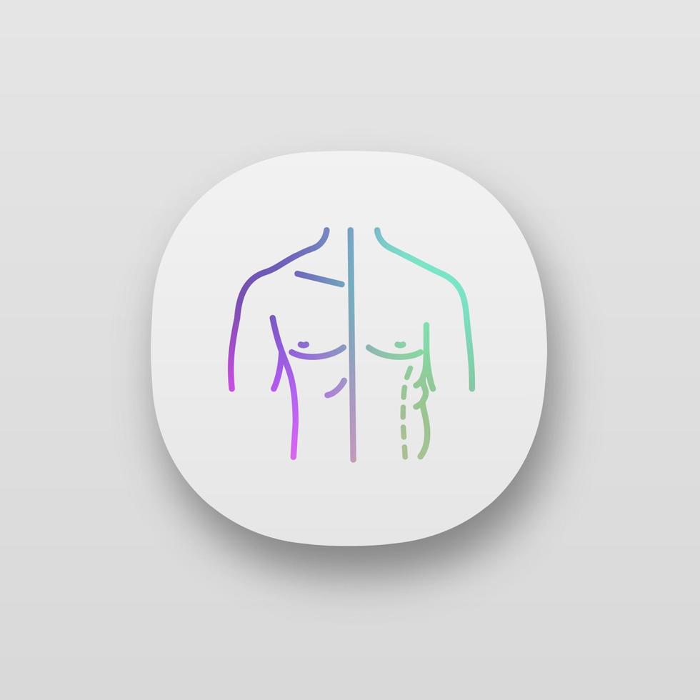 mannelijke coolsculpting app icoon. ui ux-gebruikersinterface. flanken correctie. mannelijke liposuctie en lichaamscontouren voor en na. plastische chirurgie. web- of mobiele applicatie. vector geïsoleerde illustratie