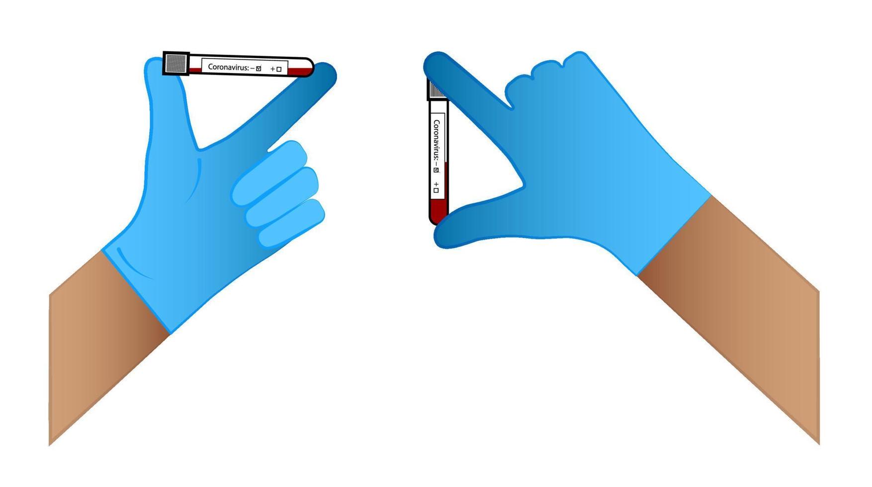 artsen leveren een handschoen in die reageerbuisjes vasthoudt met coronavirustests. positief en negatief resultaat. geïsoleerde vector op witte achtergrond