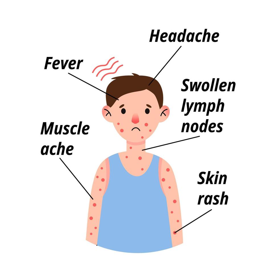 Monkeypox-virussymptoom infographic bij kindpatiënt met koorts, hoofdpijn, gezwollen lymfeklier, uitslag op gezicht, lichaam en rug, spierpijn. vector platte geïsoleerde illustratie om af te drukken.