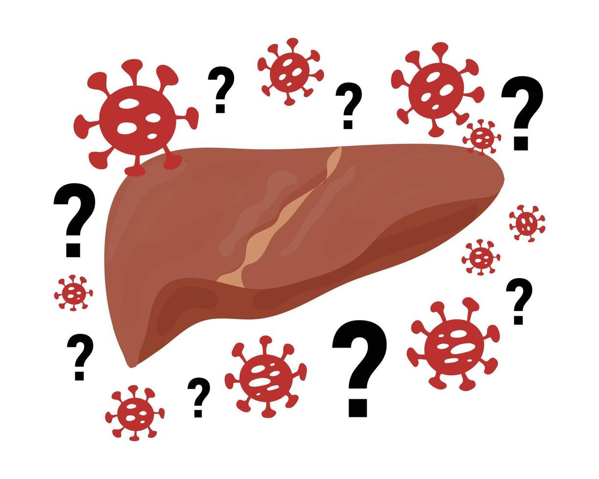 mysterieuze acute hepatitis van onbekende oorzaak concept. vectorillustratie van geïnfecteerde lever met bacteriën pictogrammen en vraagtekens geïsoleerd op een witte achtergrond. leverziekte, virale hepatitis-uitbraak vector