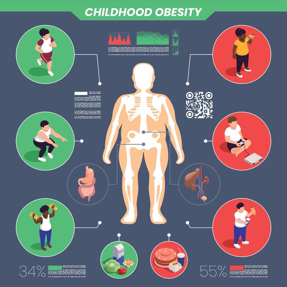 infographic set van obesitas bij kinderen vector