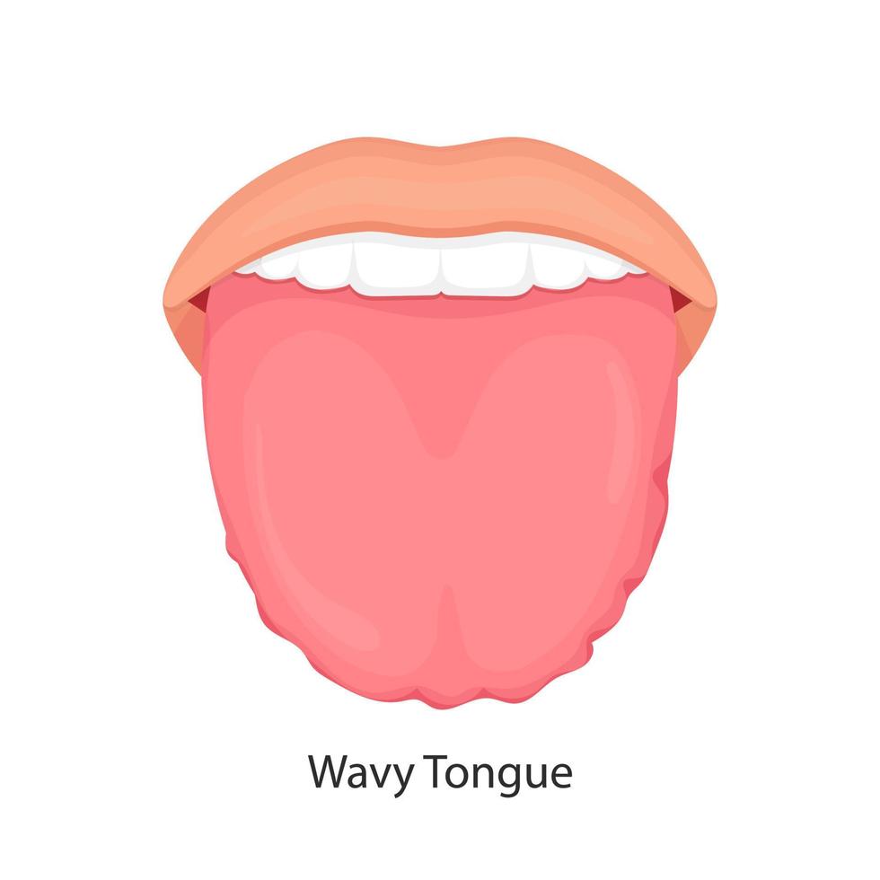 gezwollen vergrote witte tong met golvende ribbels geschulpte randen vector