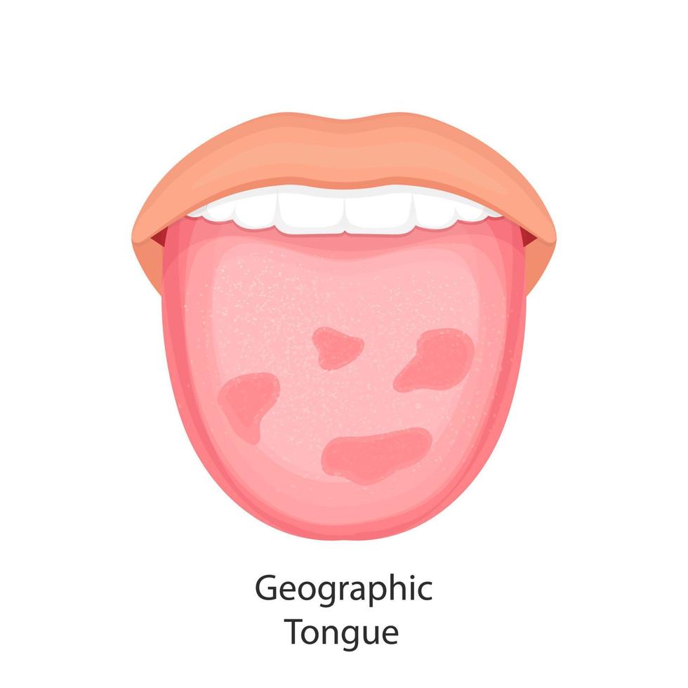 tongziekte, organen concept vector. vector