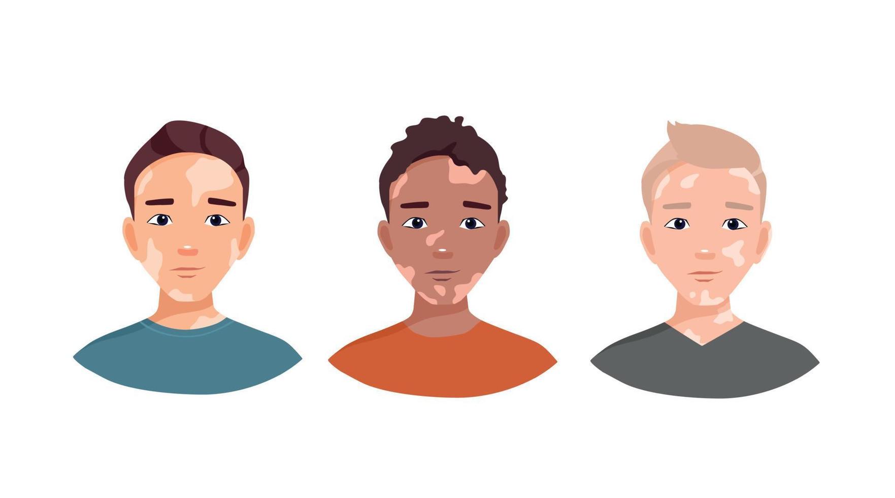 jongens met vitiligo. ideeën van verschillende schoonheid, lichaamspositief, zelfacceptatie. huidziekte. cartoon vectorillustratie vector