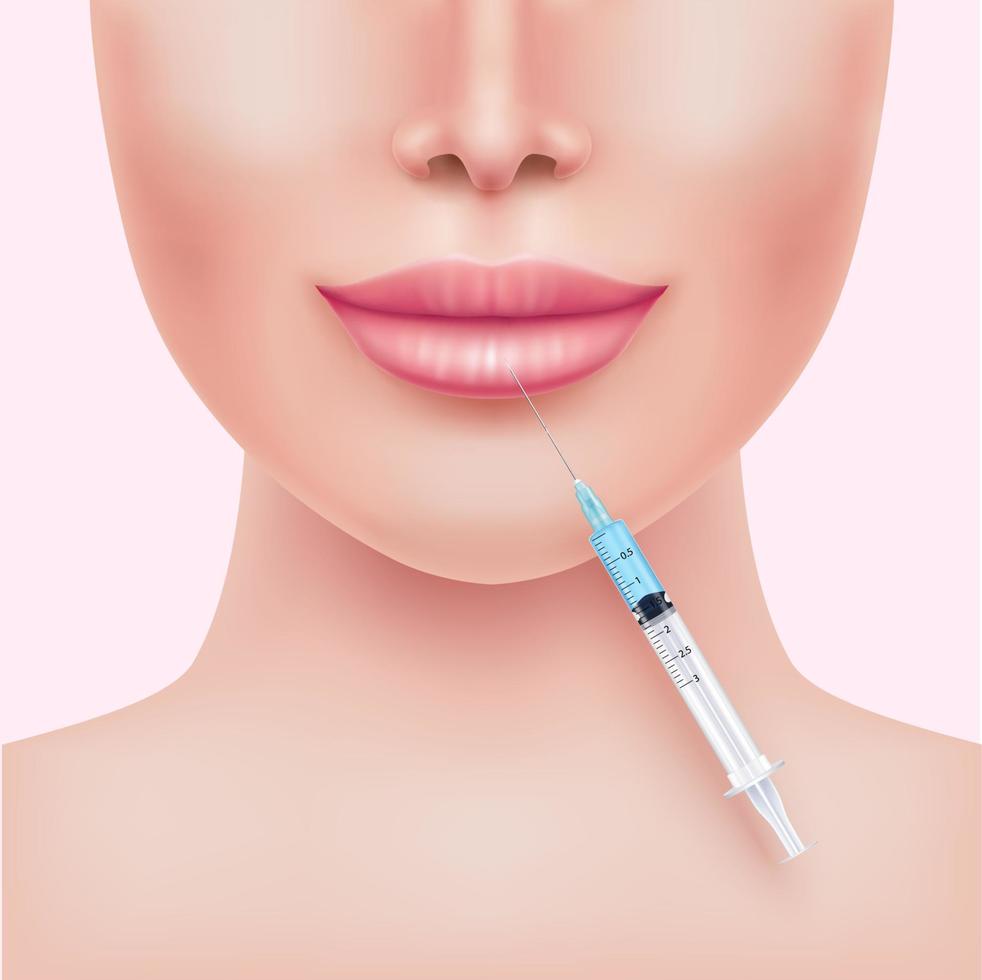 lipvergrotingsvuller in cosmetologie. hyaluronzuur gel. botox injectie lippen. medisch en schoonheidsconcept. realistische 3D-vectorillustratie eps10. vector