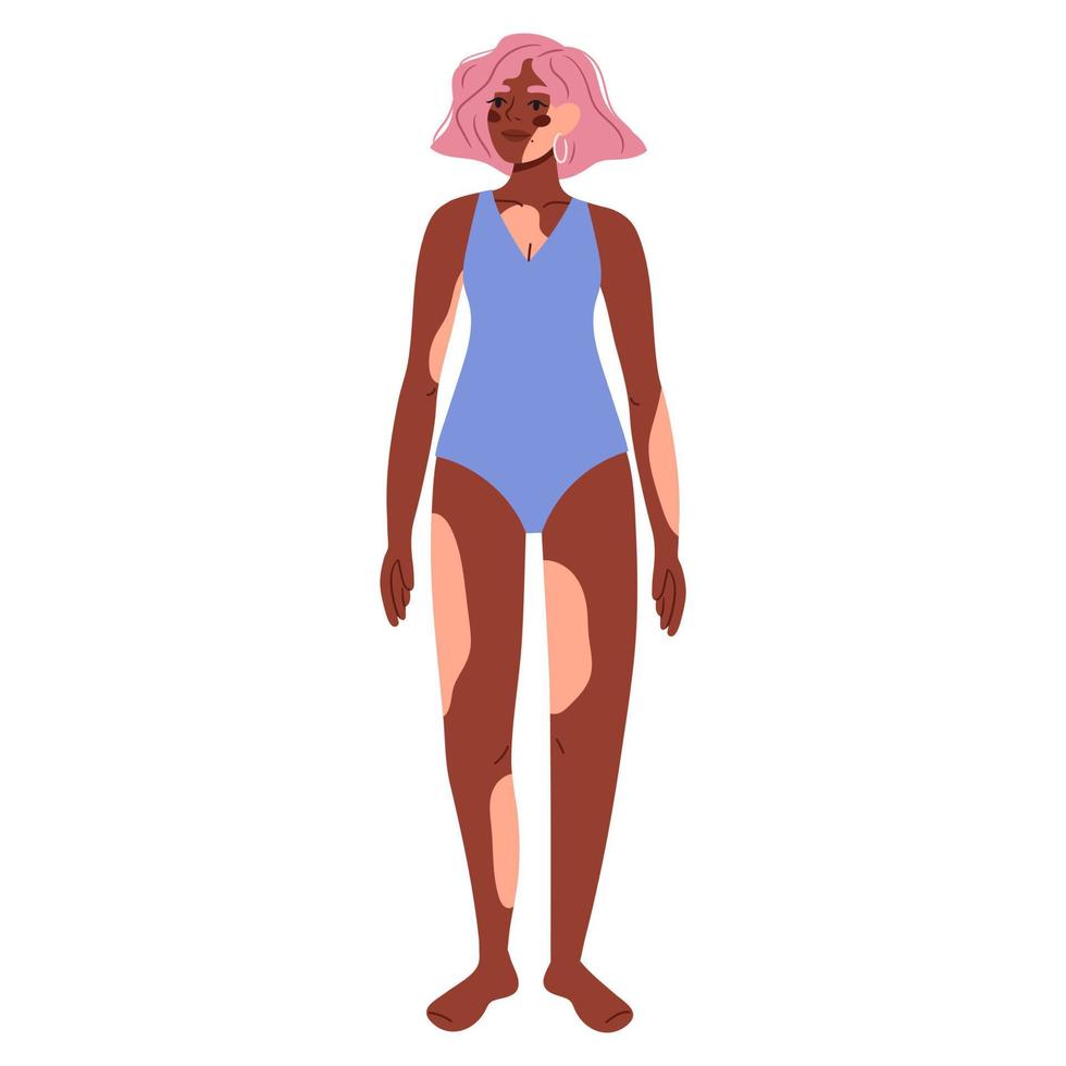 Afro-Amerikaanse vrouw met de huidziekte vitiligo in zwembroek. wereld vitiligo dag concept. zichzelf accepteren. zelf liefde. huidziekte. lichaam positief, depigmentatie ziekte. platte vector