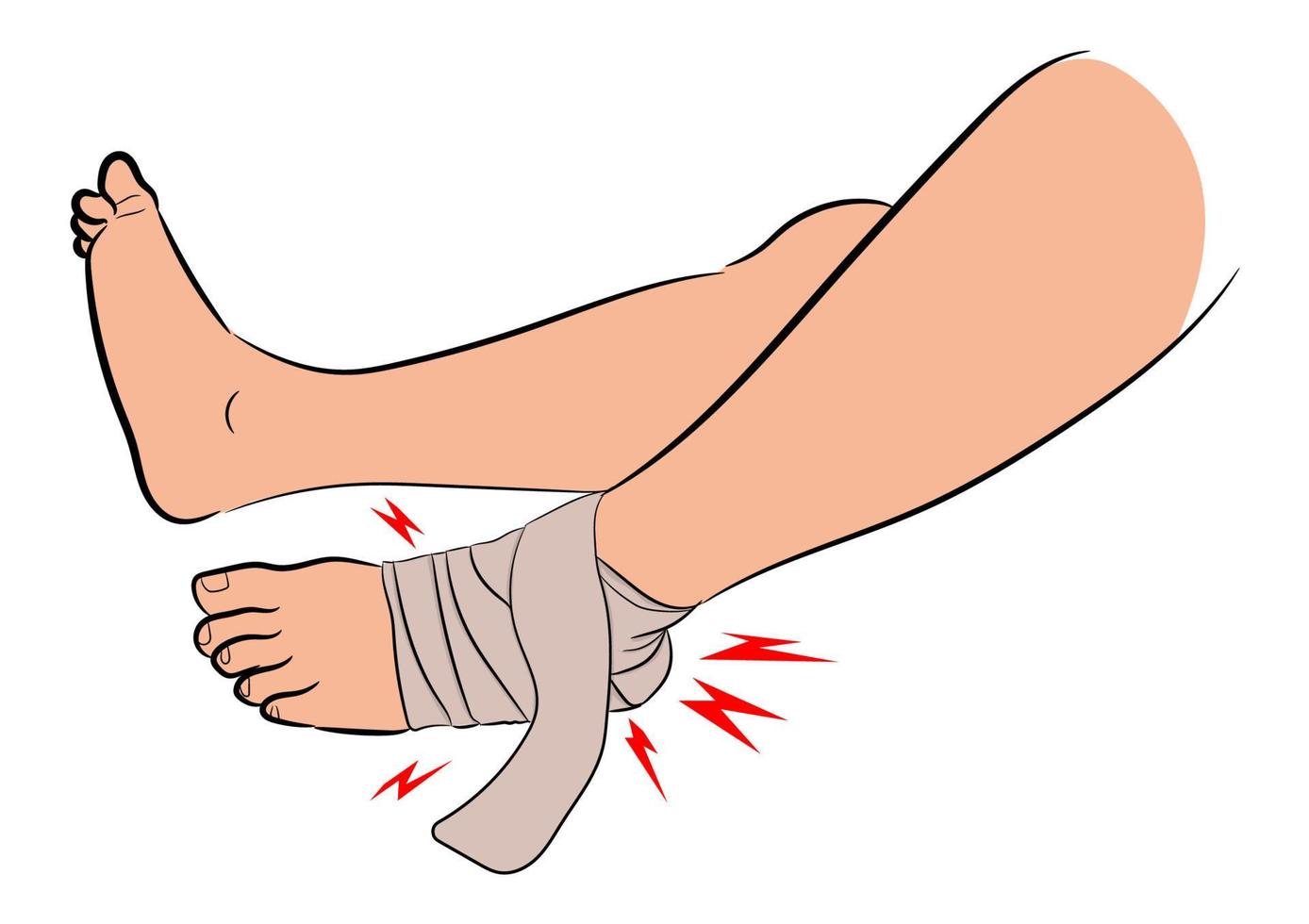 enkelverband vanwege ligament in de geblesseerde enkel, grafisch ontwerp vectorillustratie op witte achtergrond vector