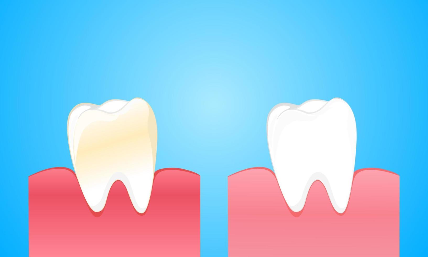 vuile tand en kauwgom zijn te vergelijken met schone en sterke witte tanden vector