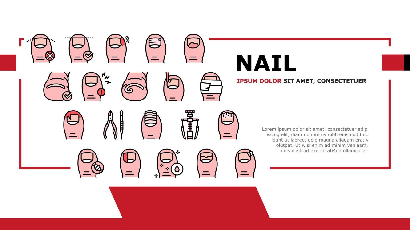 ingegroeide nagelziekte landing header vector