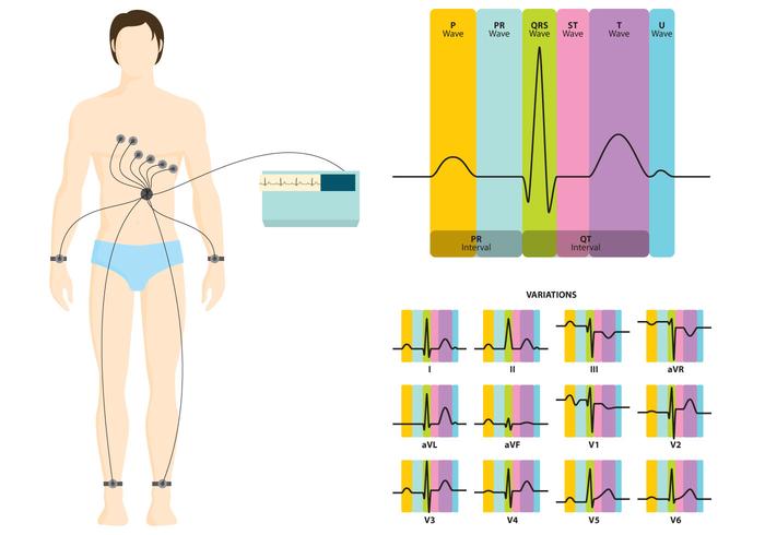 Ekg Infografie vector