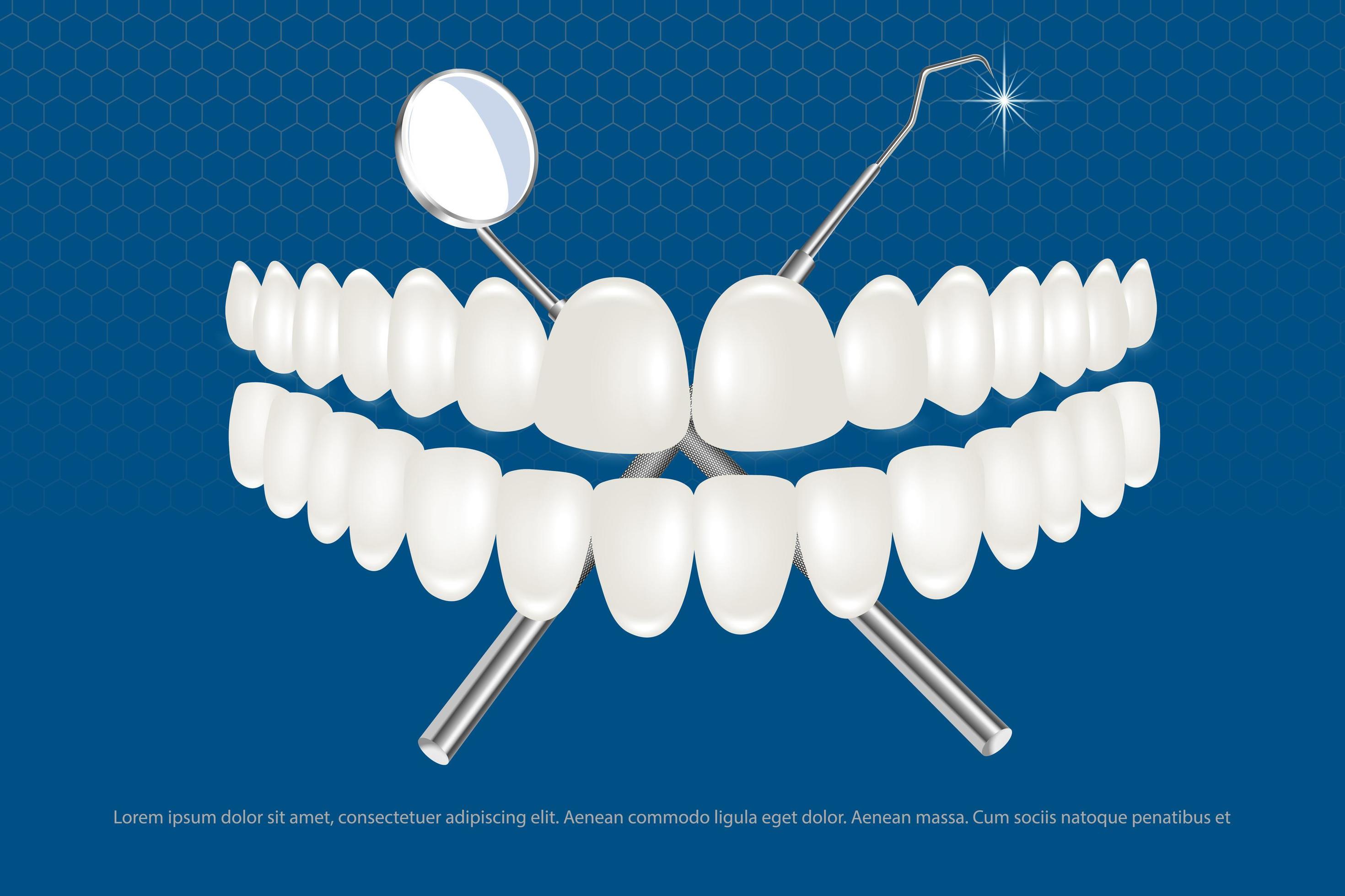 een set van witte kunstgebitten met een tandheelkundig instrument. het ontwerpconcept van en orthodontie voor medicijnen en tandpasta. gezonde mondhygiëne, kaakprothesen, 5427792 - Download Vectors, Vector Bestanden ...