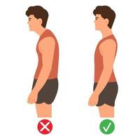 juiste en onjuiste staande houding. cervicale wervelkolom kromming. bult. gezonde back.vector afbeelding op witte achtergrond. vector