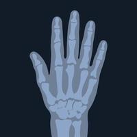 radiografisch beeld van de hand. symptomen van een fysiek examen van de gewrichten en botten van een persoon. de concept van een sterk skelet vector
