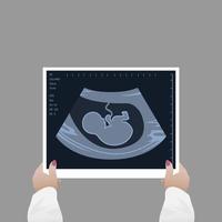 een vrouw dokter looks Bij de resultaat van een echografie scannen. medisch diagnose van een kind in de baarmoeder, zwangerschap en Gezondheid vector
