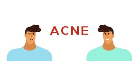 jong Mens of jongen met acne, puistjes, mee-eters. huid tiener voorwaarden concept. vlak tekening tekenfilm vector illustratie voor banier .