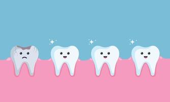 gezond wit tanden en beschadigd verduisterd tand met gat. kinderen tandheelkunde verdrietig karakter. tandheelkundig infographic elementen concept vector illustratie