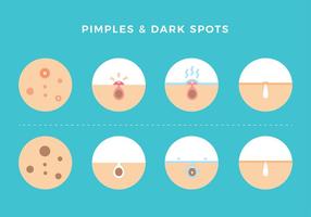 Pimples En Dark Spots Gratis Vector