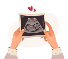 handen Holding een foto van een baby Aan echografie scannen in de baarmoeder. echografie van de kind. zwangerschap. tekenfilm vector illustratie