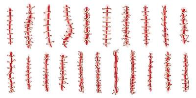 hechten pictogrammen reeks tekenfilm vector. wond chirurgisch vector