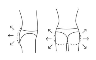 bil toenemen van vrouw, vorm kont met pijl en contour, lijn icoon. vergroting vlak, hervormen zitvlak. kunstmatig medisch procedures, kliniek van plastic chirurgie. vector schets illustratie