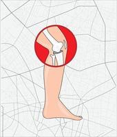 wereld artritis dag. 12 oktober vector illustrastion