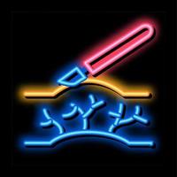 chirurgie behandeling spataderen aderen neon gloed icoon illustratie vector