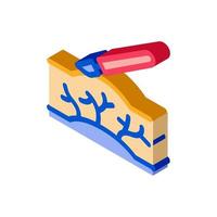 chirurgie behandeling spataderen aderen isometrische icoon vector illustratie