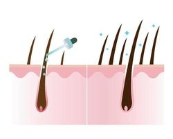 haar- dichtheid behandeling vector illustratie geïsoleerd Aan wit achtergrond.