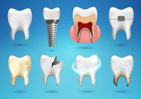tanden grote set in 3D-realistische stijl. realistische gezonde tand, tandheelkundig implantaat, cariës, gebroken, beugels. vector