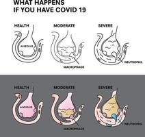 coronavirus 2019-ncov infographic, wat gebeurt er als je covid 19. virus of bacteriële longen infecteert. virus dringt longblaasjes binnen. structuur van alveolus van menselijke longen met corona. vector