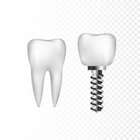 gezond wit tand en implantaat met staal schroef. tandheelkunde en tandarts zorg. vector