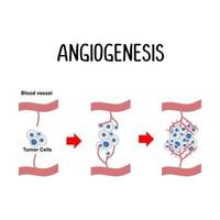 angiogenese de vorming van nieuw bloed schepen vector