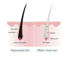 de mechanisme van gepigmenteerd haar- en wit of grijs haar- met hoofdhuid laag vector Aan wit achtergrond. haar- anatomie, haar- structuur, haar- zorg concept illustratie.