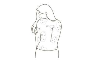 ongezond vrouw tonen rood uitslag Aan terug lijden van dermatitis. onwel meisje worstelen met dermatologie ziekte. gezondheidszorg concept. vector illustratie.