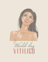 portret van een vrouw met vitiligo merken. positief lichaam concept. hand getekend tekst. wereld vitiligo dag 25 juni. vector vlak illustratie voor banier, poster.