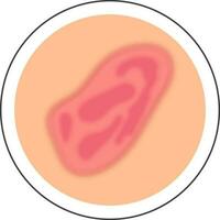 roze en perzik blauwe plek huid ziekte cirkel icoon in vlak stijl. vector