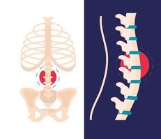 artritis reumatologie wervelkolom vector