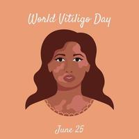 vrouwenportret met vitiligo vector
